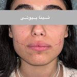 Tina Beauty Center|مرکز زیبایی تینابیوتی