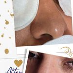 پاکسازی و آبرسانی صورت(فیشال)
