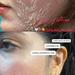 خدمات فیشیال و پاکسازی پوست