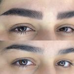 مرکز تخصصی فیبروز ابرو مژگان خناری