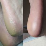 خدمات ناخن بیتا