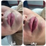 کلینیک لیزر  کندلاوزیبایی پوست ومو آیشیل
