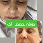 مرکز تخصصی پوست ملیکا