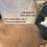 مرکز لیزر وکلینیک زیبایی پایون(بانوان)