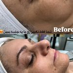 کلینیک زیبایی فشیال دکتر هدیه دهقان پور