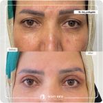 کلینیک پوست مو و زیبایی نوین ایرانا