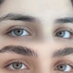 لیفت ابرو آیدا عزیزی