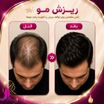 کلینیک پوست و زیبایی ژیلاوَش