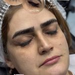 خدمات تخصصی آرایش دائم وریموواستادحمیدی