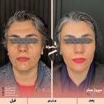 مرکز پزشکی و زیبایی میروژ سنتر