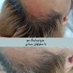 خدمات تخصصی ودرمانی با سلولهای بنیادی