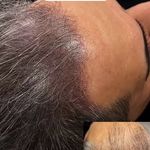 مرکز میکرواسکالپ عطار