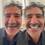 دندانسازی محلات (فتح المبین )