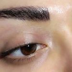 میکروبلدینگ ومیکروپیگمنتیشن حسینی