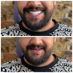 مجموعه دندان پزشکی و دندان سازی نچرال