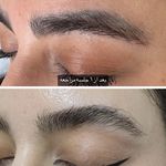 خدمات تخصصی ریمو تتو آزیتا