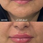 کلینیک لیزر و زیبایی دکتر لیلا حسینی