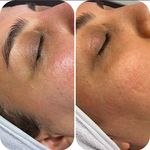 مرکز پاکسازی  و فیشال  تخصصی پوست سارا