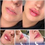کلینیک زیبایی و لیزر سلن مشهد