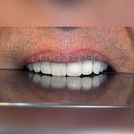 دندانپزشکی زیبایی دکتر پریسا دهقانی