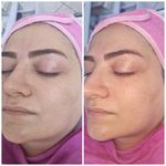 خدمات ناخن مینا میرزایی