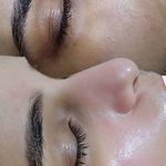 فیشال پاکسازی پوست