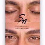 میکروبلیدینگ ابرو و میکرواسکالپ سر آقایان