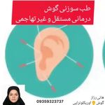 طب سوزنی گوش 👂