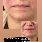 کلینیک پوست و مو و لیزر نیلوفر آبی