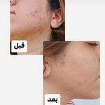 دکتر مریم موسویان ویزیت آنلاین پوست و مو