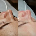 سالن مراقبت پوست ،مو وزیبایی آقایان_فیشال تخصصی