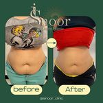 مرکز تخصصی لاغری سی نور