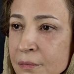 کلینیک زیبایی الماس کاملا اقساطی