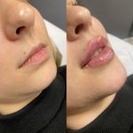 کلینیک پوست،مو،زیبایی،مرکز لیزر ‌پرنسا