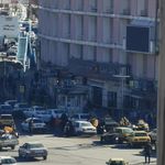 مرکز  کاشت مو و جراحی نور کرمانشاه