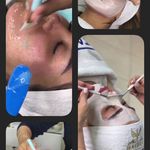 فیشال تخصصی و پاکسازی پوست مَلکا