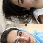 کلینیک زیبایی کاترین