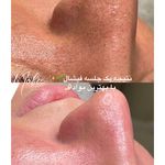 کلینیک زیبایی و لیزر مو زائد نوبا