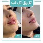 کلینیک لیزر و زیبایی لیلیا