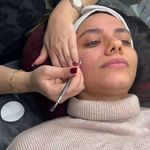 فیشیال تخصصی پریناز رسولی