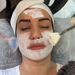 فیشیال تخصصی پریناز رسولی