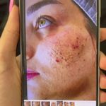 کلینیک زیبایی پوست ومو ولیزر پرمیس