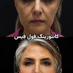 مطب پوست مو لیزر و زیبایی آریاناز