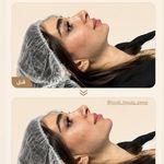 مرکز لیزر ،پوست و زیبایی کندی بیوتی