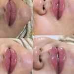 کلینیک زیبایی کاترین