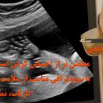 سونوگرافی، رادیولوژی دیجیتال بازتاب