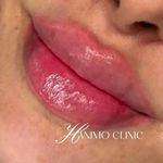 کلینیک زیبایی حانیمو