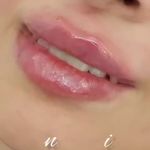 کلینیک زیبایی حانیمو