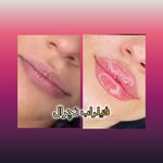 مطب پوست ،مو و لیزر یسنا طب