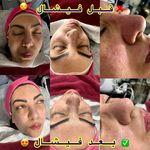 کلبه پوست لاوین